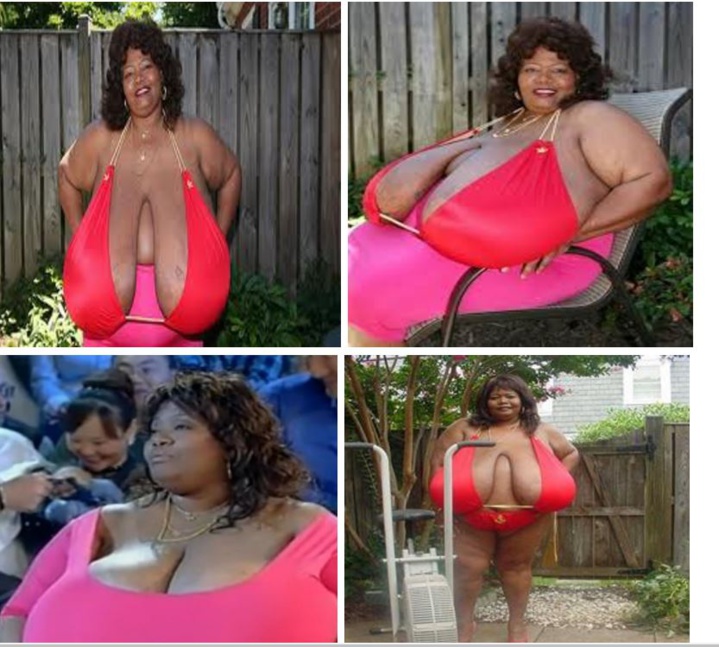 ​Insolite : Ses deux seins pèsent 50 kilos, la femme à la plus forte poitrine naturelle au Monde