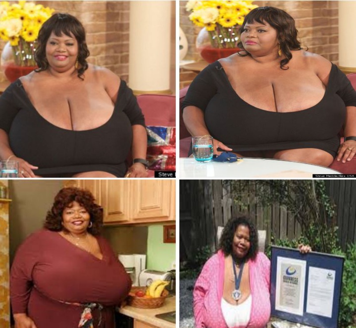 ​Insolite : Ses deux seins pèsent 50 kilos, la femme à la plus forte poitrine naturelle au Monde ​Insolite : Ses deux seins pèsent 50 kilos, la femme à la plus forte poitrine naturelle au Monde