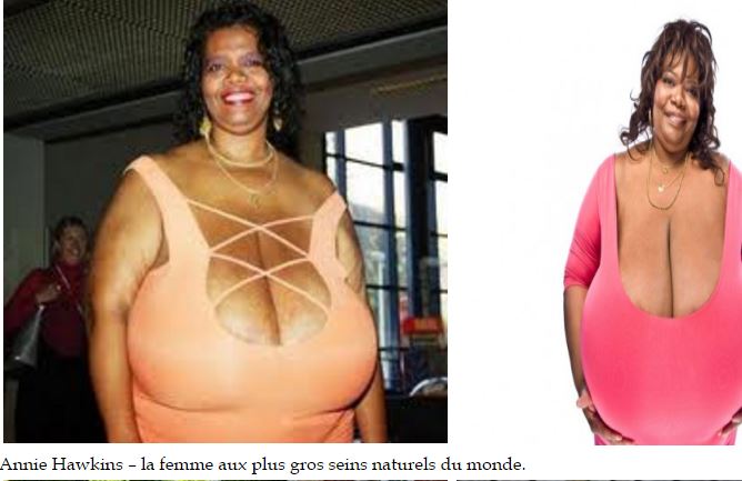 ​Insolite : Ses deux seins pèsent 50 kilos, la femme à la plus forte poitrine naturelle au Monde ​Insolite : Ses deux seins pèsent 50 kilos, la femme à la plus forte poitrine naturelle au Monde