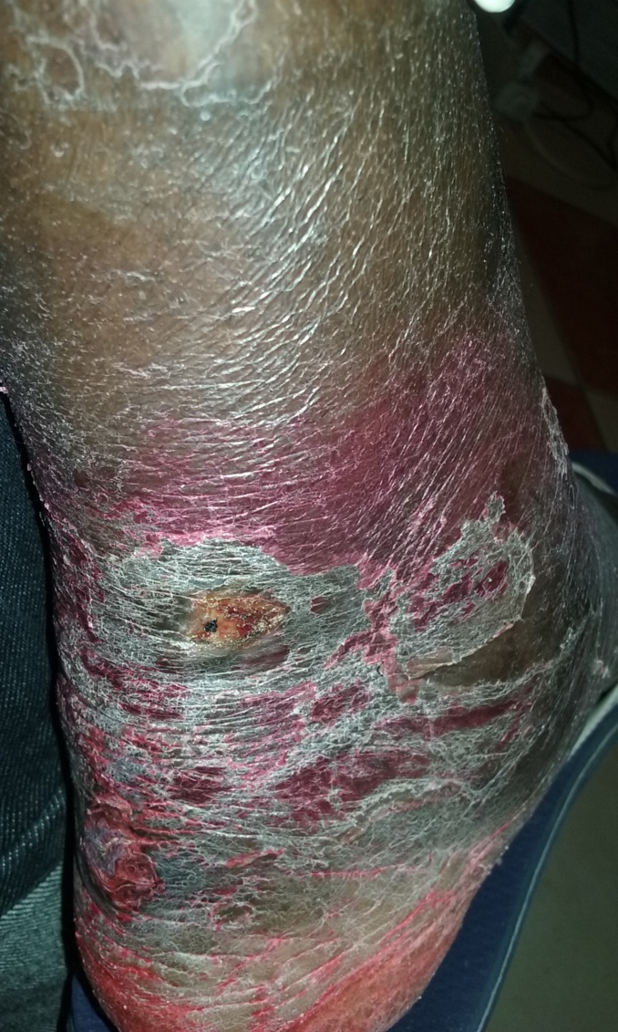 Appel à l'aide : « Mon ex-femme m’a transmise une maladie bizarre, j'ai l'impression d'avoir une grenouille dans mon ventre » Appel à l'aide : « Mon ex-femme m’a transmise une maladie bizarre, j'ai l'impression d'avoir une grenouille dans mon ventre »