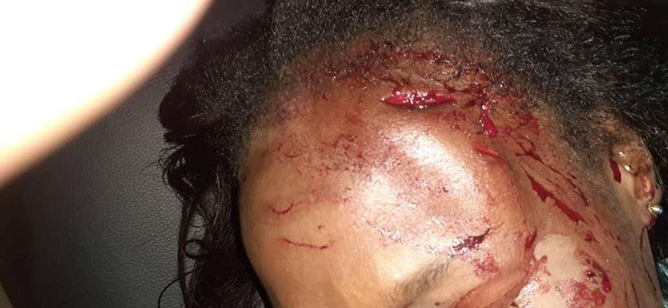 Images choquantes: Voici la sage-femme agressée par un Kankourang à Sédhiou Images choquantes: Voici la sage-femme agressée par un Kankourang à Sédhiou