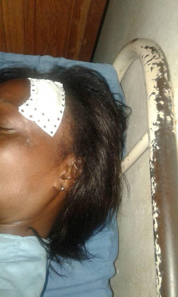 Images choquantes: Voici la sage-femme agressée par un Kankourang à Sédhiou Images choquantes: Voici la sage-femme agressée par un Kankourang à Sédhiou