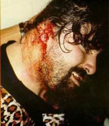 CANNIBALISME EN FRANCE