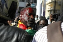 Victimes des violences policières lors du processus électoral de 2012 : Vers une indemnisation des victimes par l’Etat du Sénégal. Victimes des violences policières lors du processus électoral de 2012 : Vers une indemnisation des victimes par l’Etat du Sénégal.