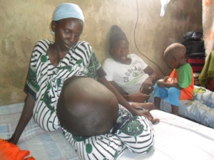 Photos - Comment Ndoye Bane a sauvé cette femme atteinte d'une étonnante maladie
