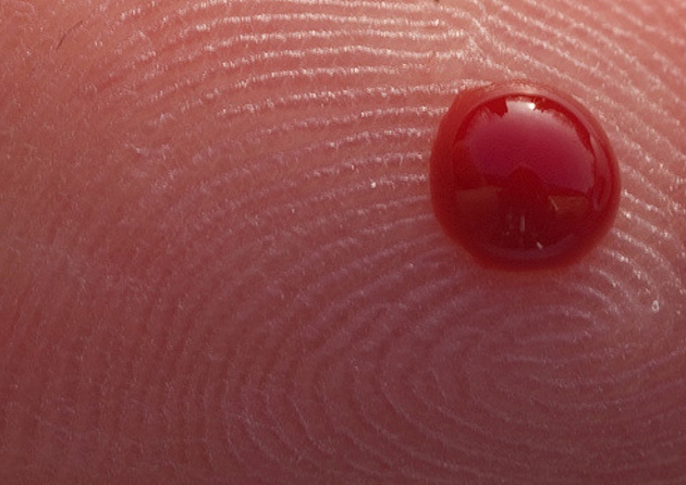 10 faits surprenants sur le sang et les groupes sanguins