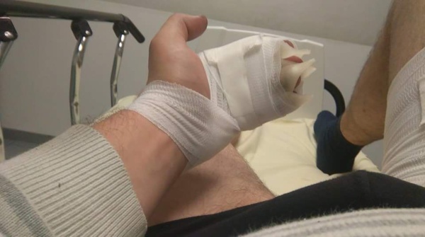 La batterie de la cigarette électronique explose, sa voiture prend feu