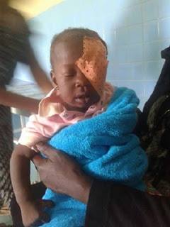 Miracle: Un Bébé a survécu après l’accident de train mortel au Cameroun