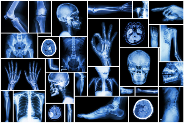 le 8 novembre, Journée internationale de la radiologie