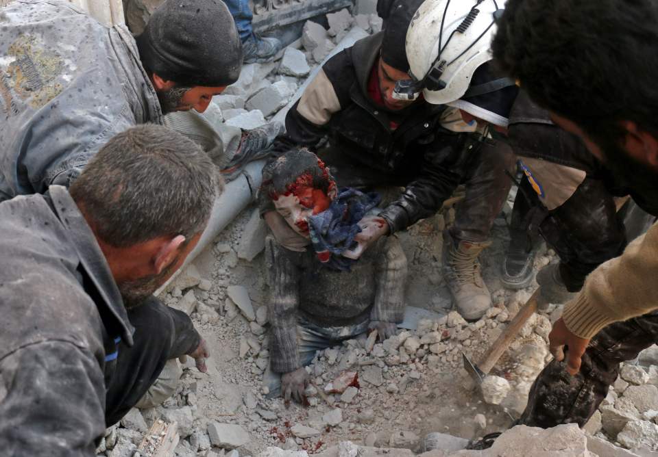 7 photos : Âmes sensibles s'abstenir : un enfant détérré des décombres tout en sang en Syrie, regardez