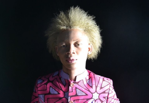 A Kinshasa, des albinos défilent pour faire valoir leur beauté