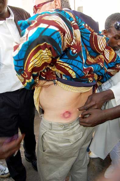 SÉVÈRE REPRESSION POLICIÈRE CONTRE LES JEUNES DE REBEUSS ET MÉDINA : 7 personnes arrêtées, Khalifa Sall malmené, Aly Aïdar reçoit une balle en caoutchouc