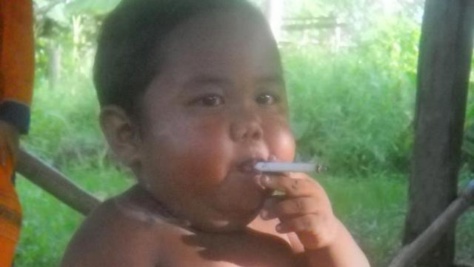 Aldi, le petit Indonésien qui fumait des cigarettes à deux ans, s'est débarrassé de son addiction