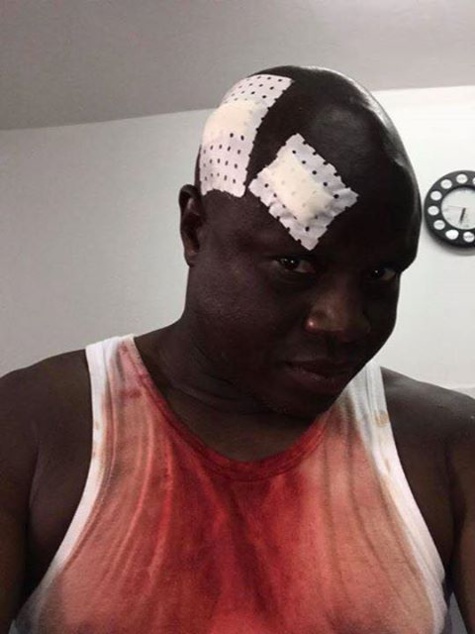 Photo: Amara Traoré agressé au Stade Caroline Faye de Mbour