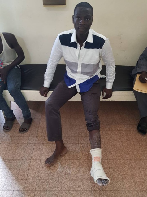 Assemblée nationale: Gallo Tall du PDS, sort en boitillant et accuse la police