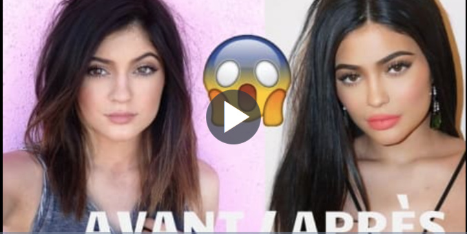 Avant / Après : Kylie Jenner, son incroyable transformation physique