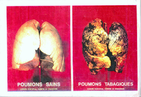Sénégal : de nouveaux paquets de cigarettes avec des avertissements contre le tabagisme