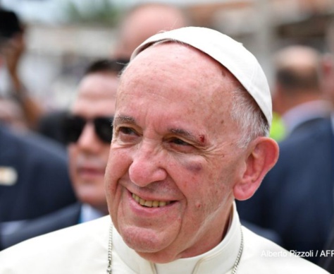 Le pape se blesse légèrement au visage après un freinage brutal de sa papamobile