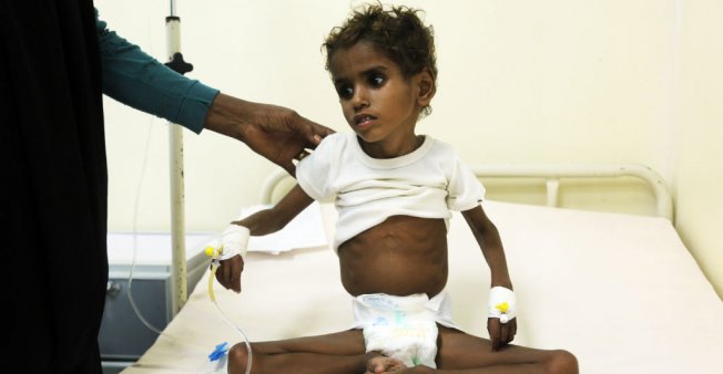Sept millions de Yéménites souffrent de la famine, selon les Affaires humanitaires de l'ONU.