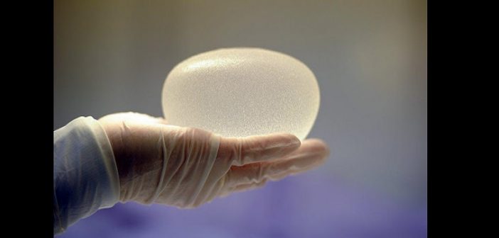 Santé: Les implants mammaires liés à un risque accru de cancer rare