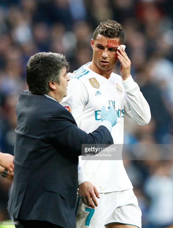 16 photos : blessé, Cristiano Ronaldo demande un téléphone au membre du staff médical