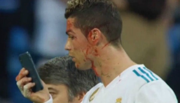 Il faut sauver le soldat Ronaldo