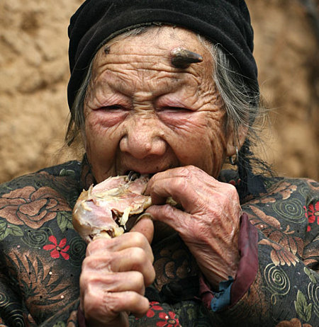 [Vidéo / Photo ] Une femme chinoise a des cornes qui poussent sur son front