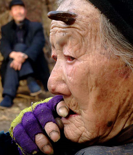 [Vidéo / Photo ] Une femme chinoise a des cornes qui poussent sur son front