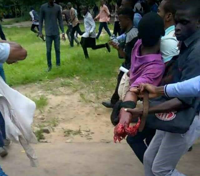 RD Congo- Un étudiant de  l'UNIKIN perd sa main lors de la manifestation