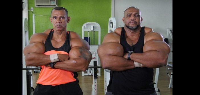 Brésil: ils s’injectent des produits chimiques pour gonfler leurs biceps (Photos)