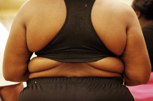 Obésité : 1 femme sur 4 touchée Obésité : 1 femme sur 4 touchée