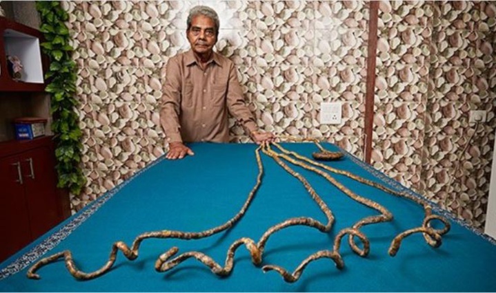 L'homme aux ongles les plus longs du monde a fini par les couper (vidéo)