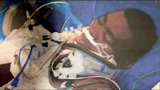 Joueur né à Dakar : Plongé dans le coma depuis 36 ans, la femme de Jean Pierre Adams parle !