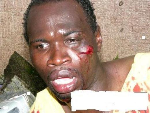 ITALIE: Un jeune sénégalais sauvagement agressé par des italiens