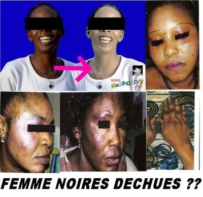 Le khessal : une pratique sénégalaise agressive qui se conjugue au féminin