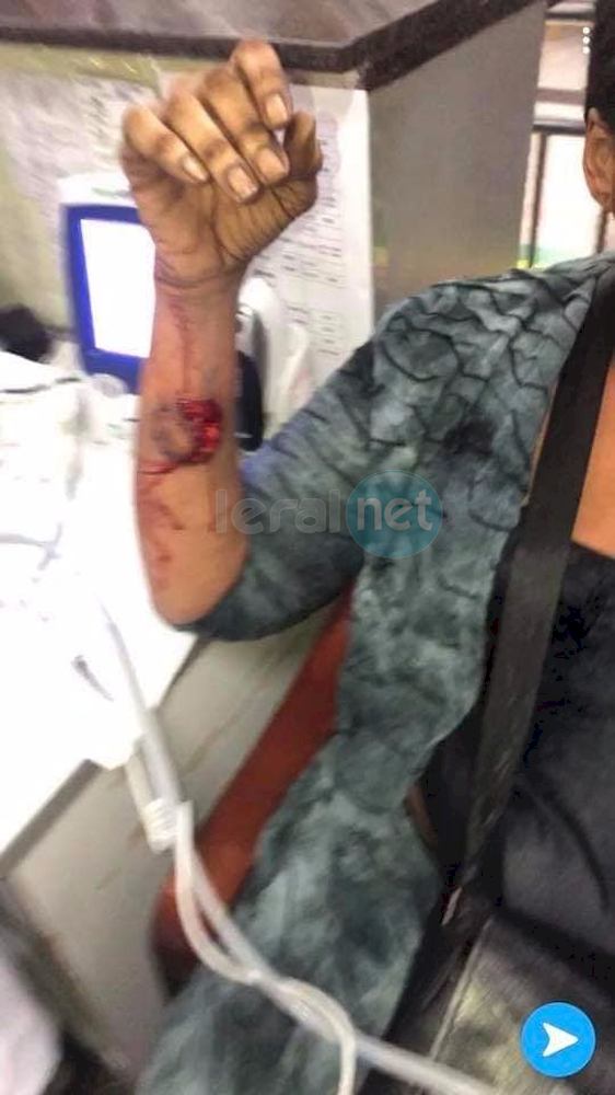  10 photos: La dame agressée en Chine par sa coépouse (âmes sensibles s'abstenir)