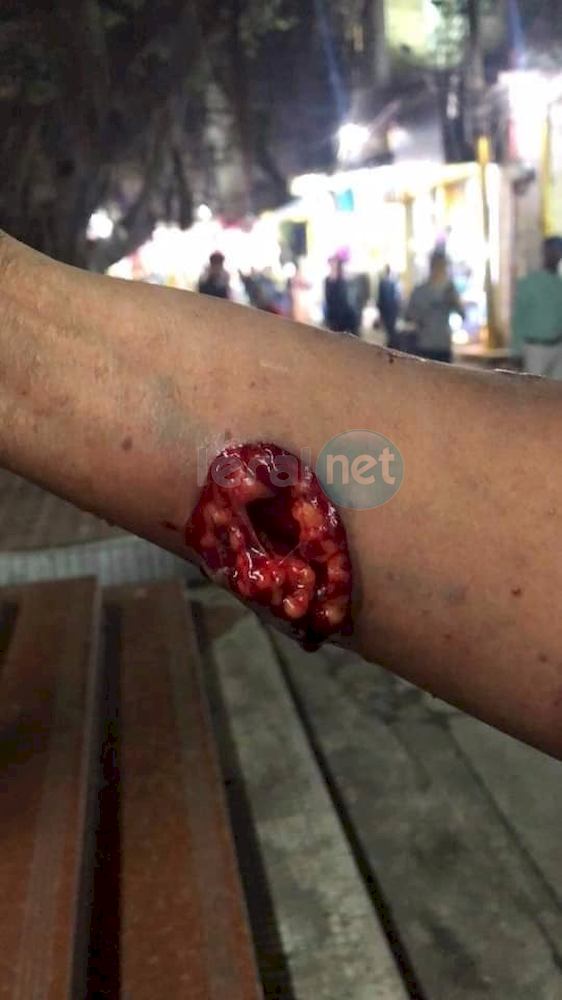  10 photos: La dame agressée en Chine par sa coépouse (âmes sensibles s'abstenir)
