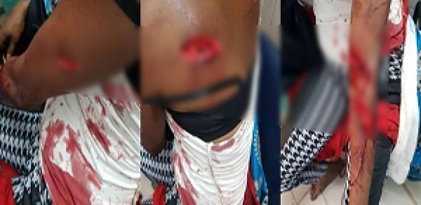 Coépouse "charcutée" : Le procès de Salimata Diaw renvoyé à nouveau