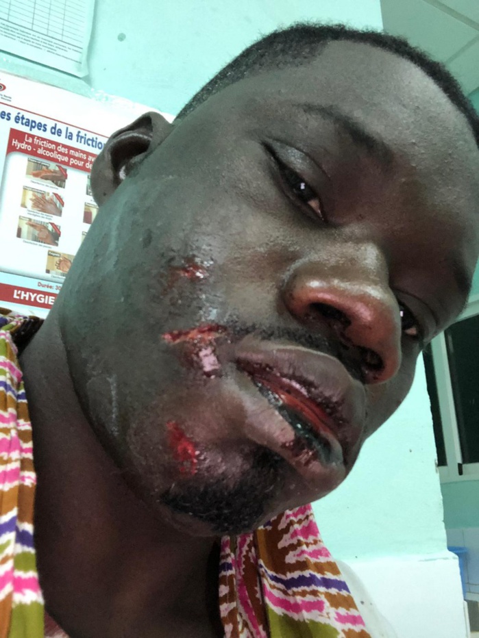 Urgent : Guin Thieuss sauvagement agressé...