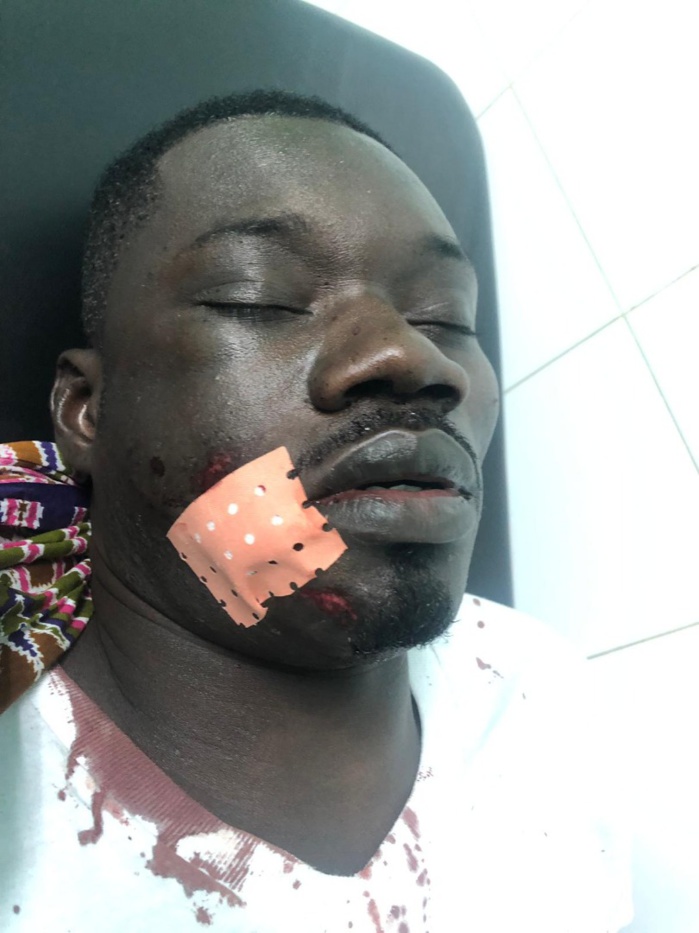Urgent : Guin Thieuss sauvagement agressé...