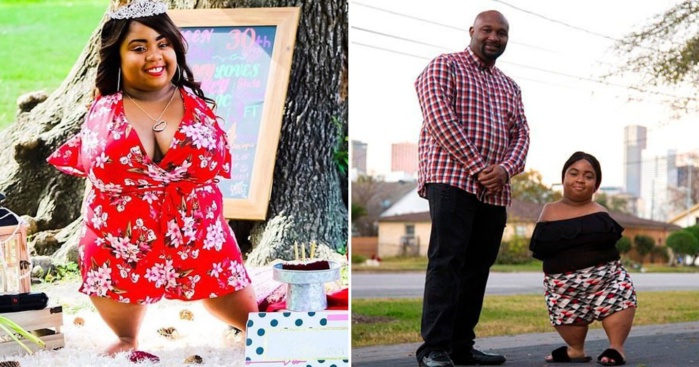 Photos : Une femme née sans bras ni genoux trouve l’amour