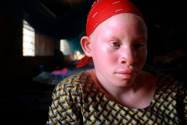 Pour être élu, le candidat à la présidentielle 2012 débourse dix millions pour un litre de sang d'un albinos