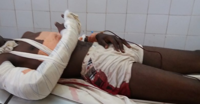 Université Assane Seck de Ziguinchor: L'étudiant Mamadou Ly blessé par balle blanche