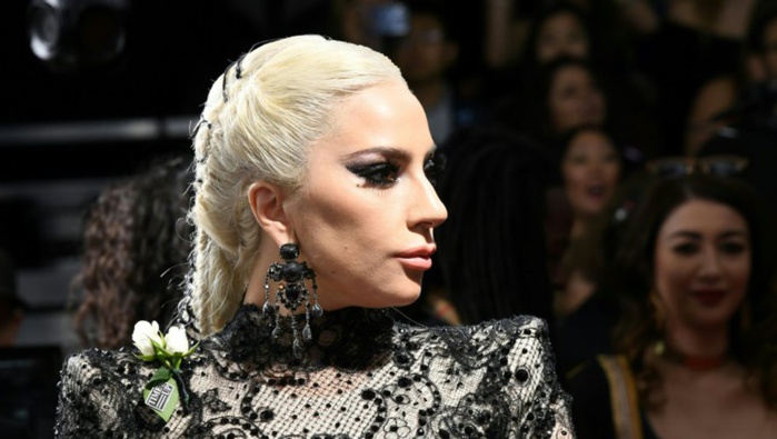 Las Vegas: Lady Gaga chute en plein concert