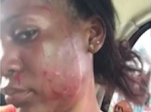 Ghana: Une femme battue par son amant marié et son épouse