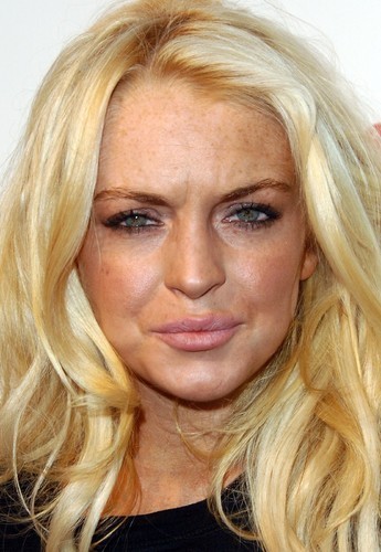 Trop de Botox tue le Botox : les stars qui abusent...