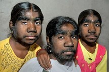 [PHOTOS] Les filles les plus poilues du monde !