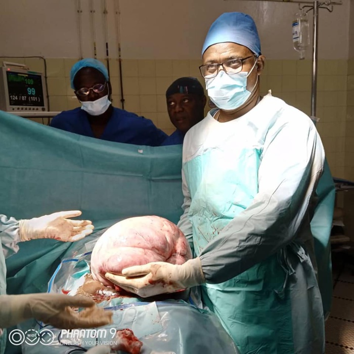 Photos: fibrome de dix kilogrammes retiré d'une dame à Thiès