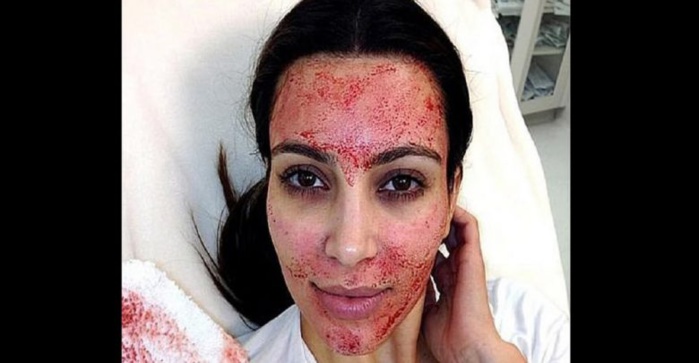 Kim Kardashian intente un procès contre un médecin esthétique