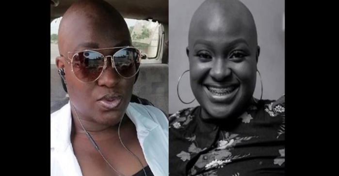 Adwowa Obeng, la ghanéenne qui n’a jamais eu de cheveux en 22 ans fait des confidences